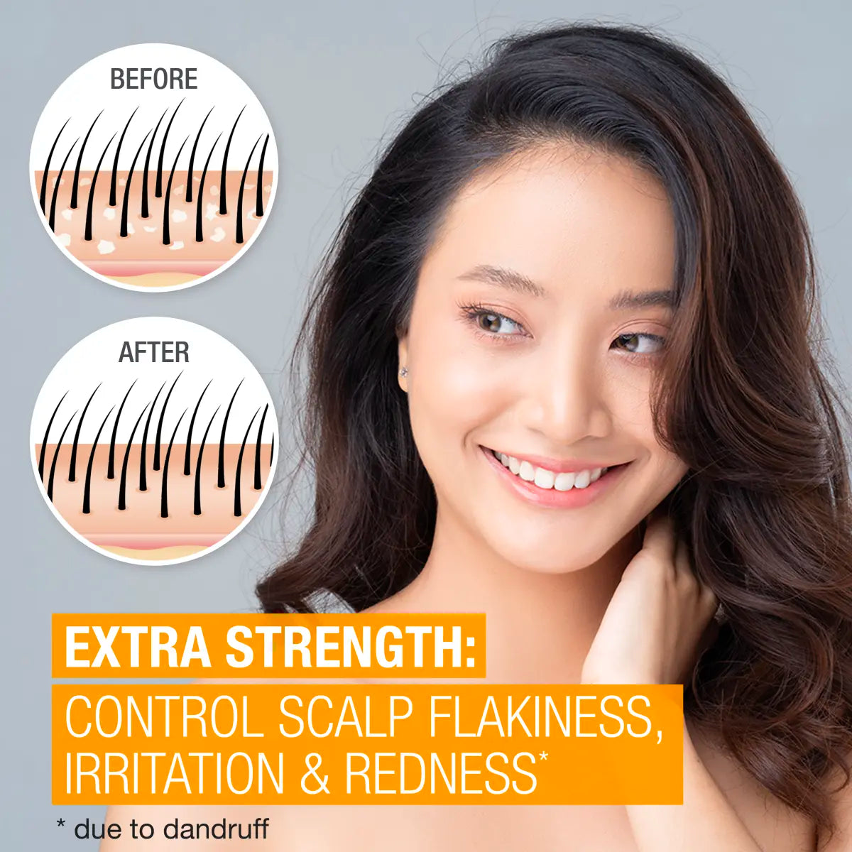 Neutrogena® Scalp Therapy Anti-dandruff Extra Strength product image 2