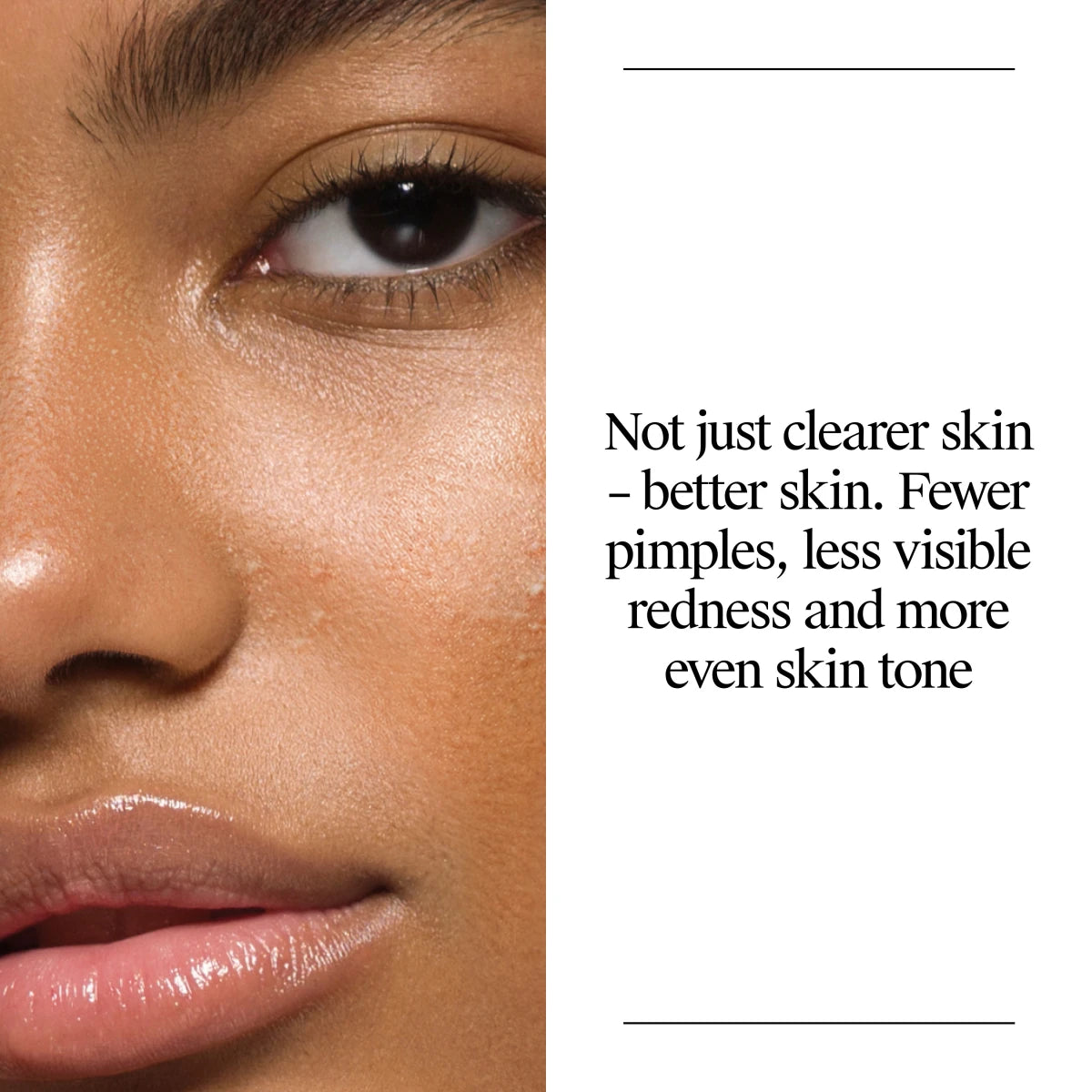 Neutrogena® Oil Free Acne Wash product image 4