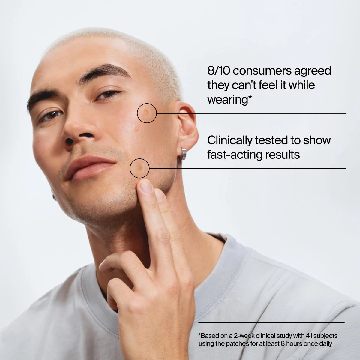 Neutrogena® Stubborn Acne Ultra-Thin Blemish Patches, Combination Pack, 24 Patches product image 4