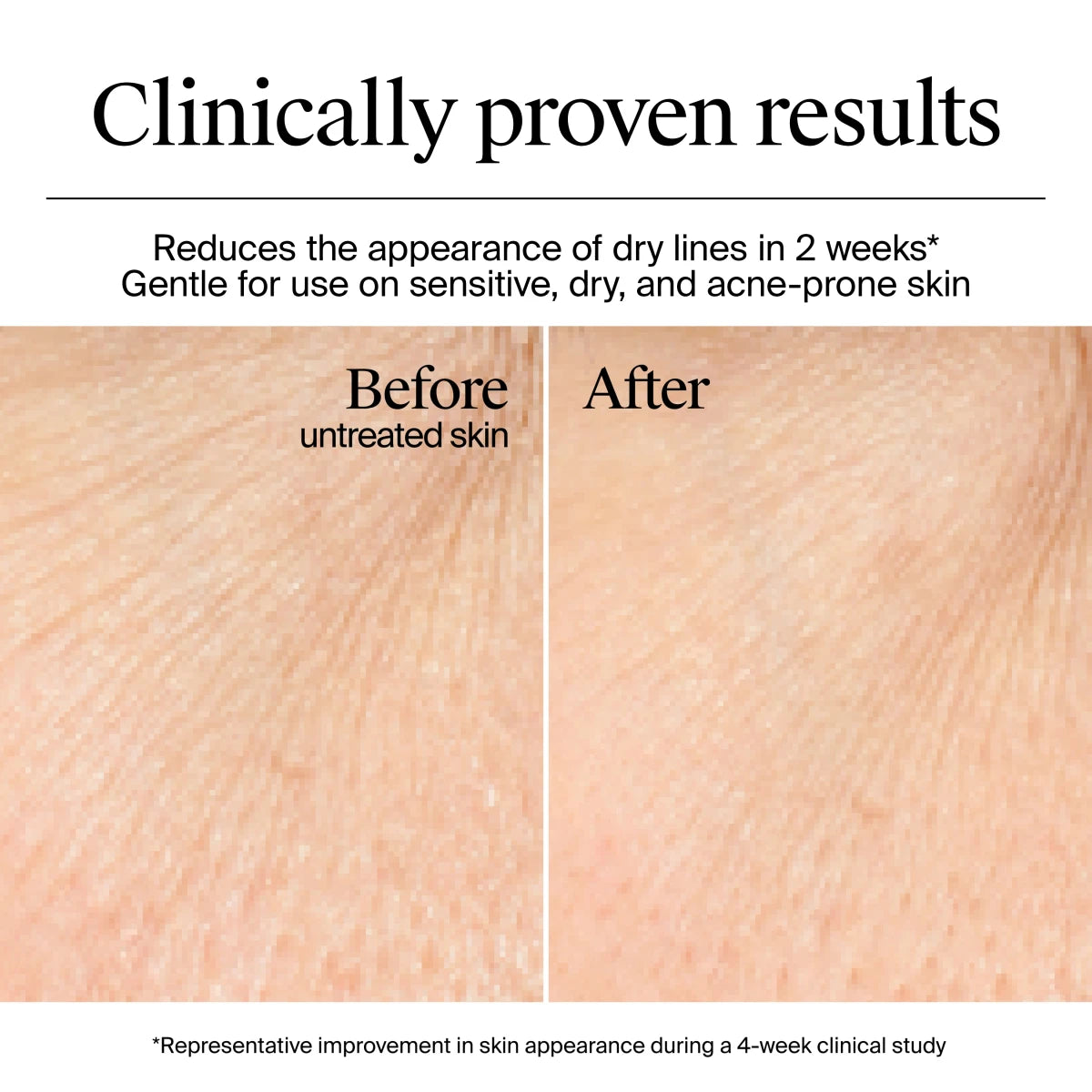 Neutrogena® Hydro Boost Hyaluronic Acid Gel Cream Fragrance Free product image 5