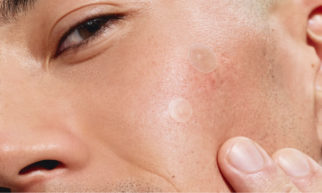 Neutrogena® Mini Acne Patch, Sensitive Skin product image 10