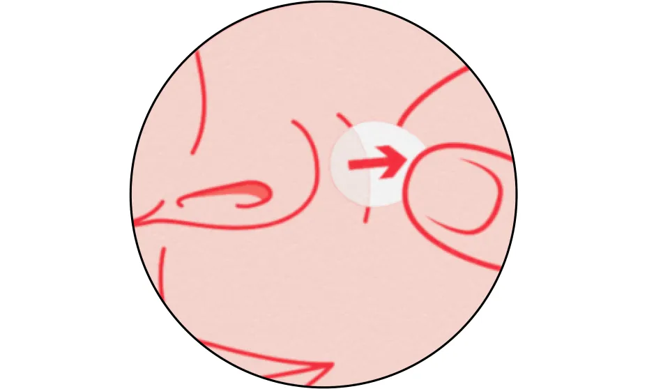 Neutrogena® Mini Acne Patch, Sensitive Skin product image 15