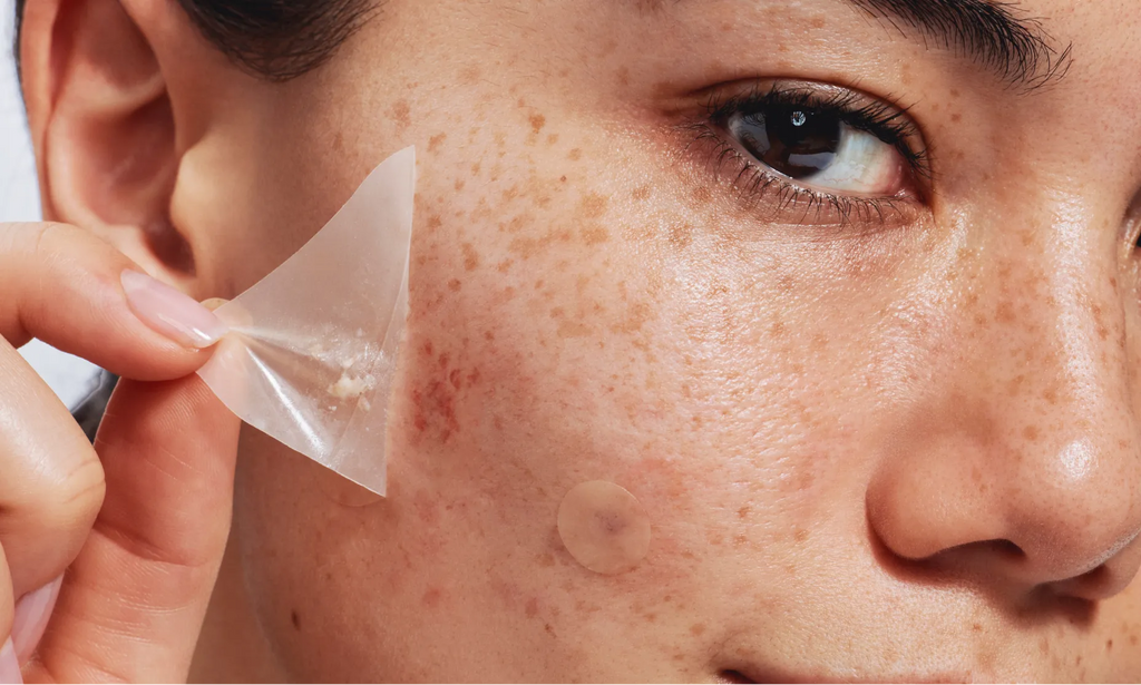 Neutrogena® Sensitive Skin Triangle Acne Patches product image 10