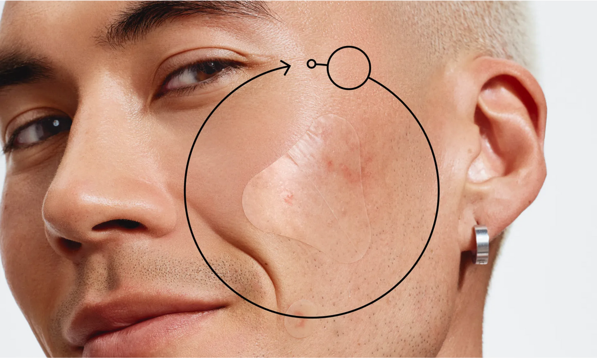 Neutrogena® Sensitive Skin Triangle Acne Patches product image 11