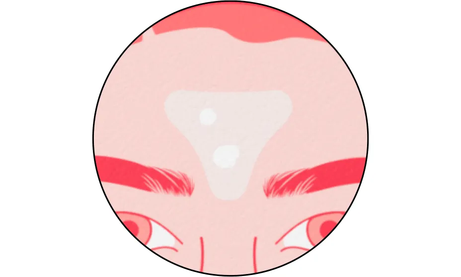Neutrogena® Sensitive Skin Triangle Acne Patches product image 14