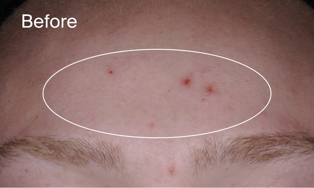 Neutrogena® Evenly Clear™ Acne Cleanser product image 12