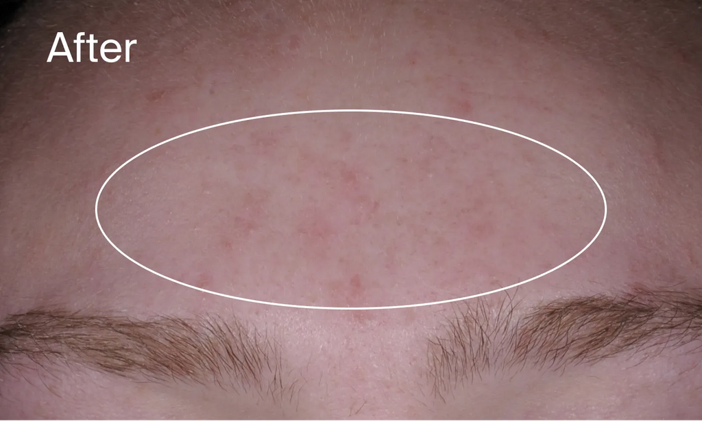 Neutrogena® Evenly Clear™ Acne Cleanser product image 13