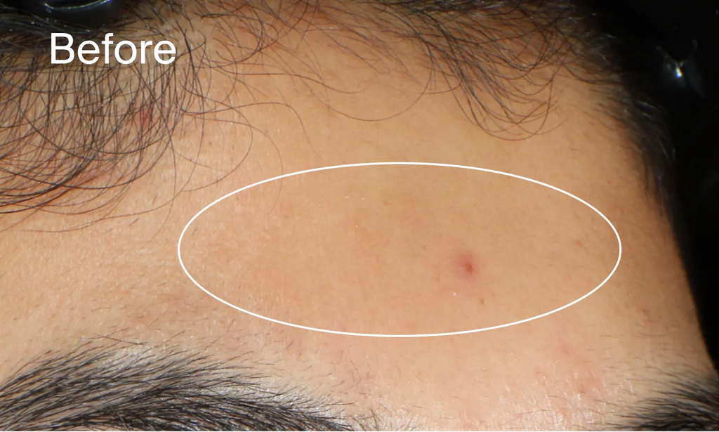 Neutrogena® Evenly Clear™ Acne Gel Moisturizer product image 14