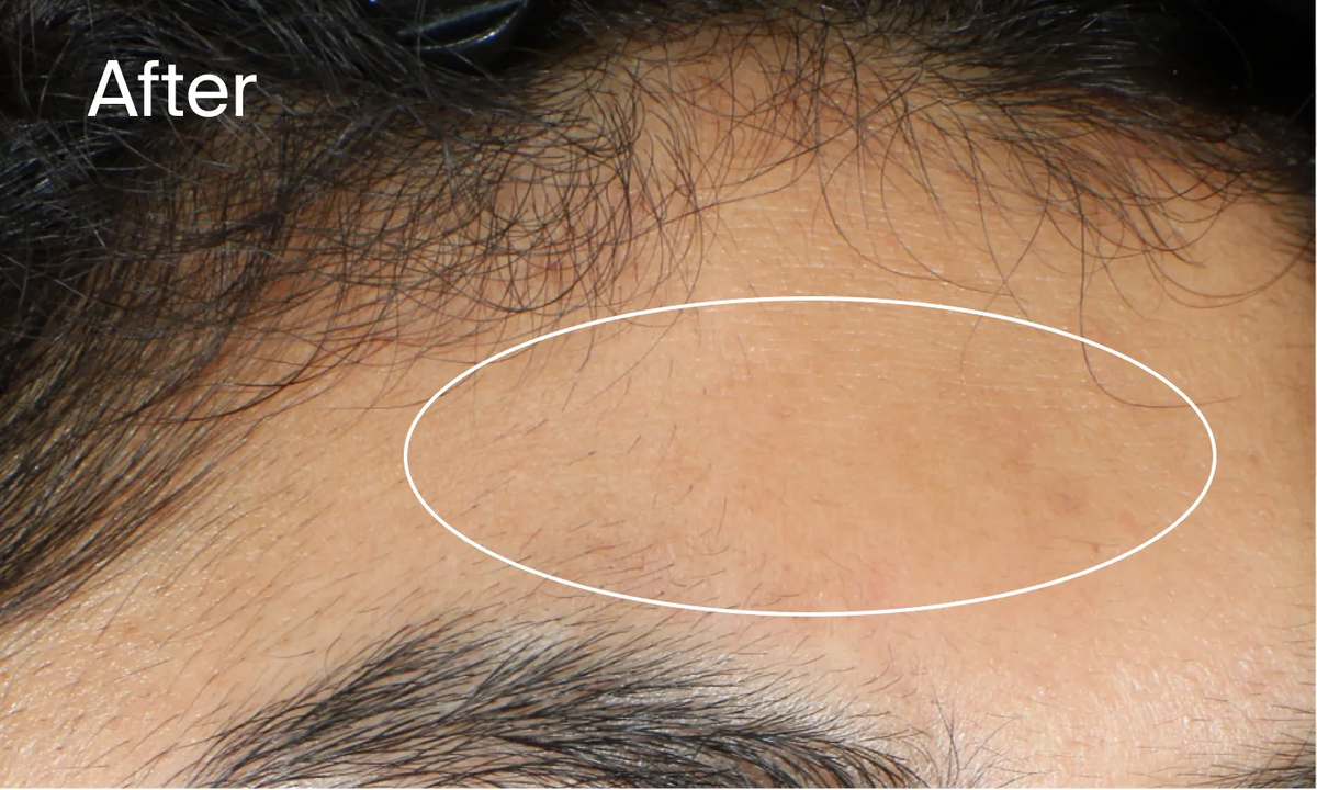 Neutrogena® Evenly Clear™ Acne Gel Moisturizer product image 15