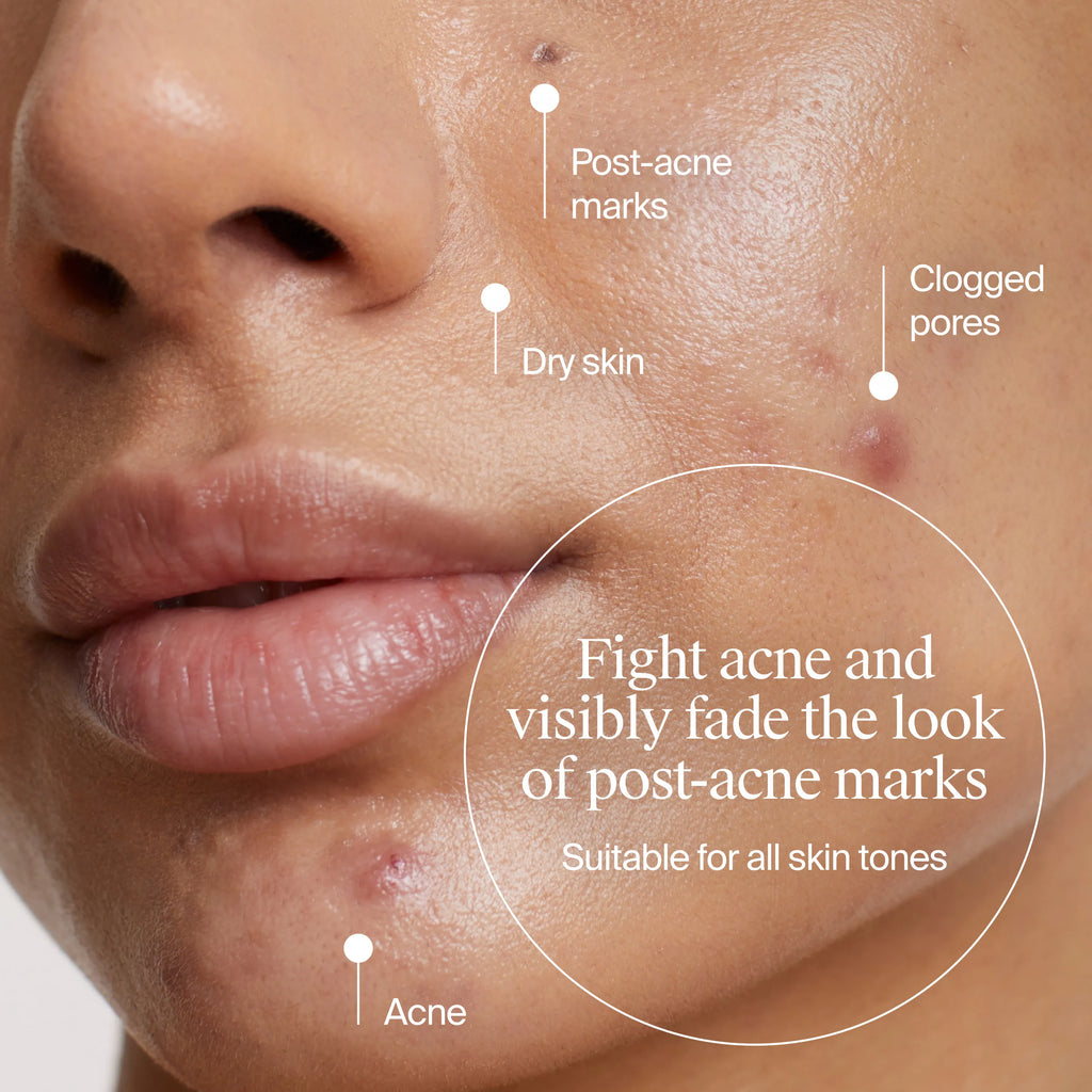 Neutrogena® Acne-Fighting Skincare Solutions Regimen Duo product image 6