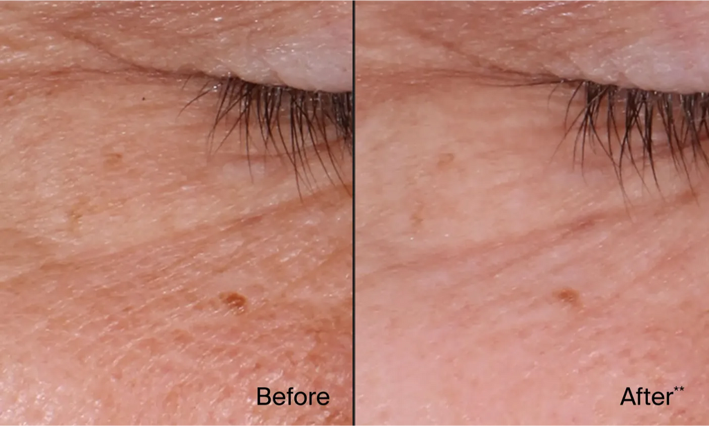 Neutrogena® Rapid Wrinkle Repair Retinol Regenerating Cream product image 9