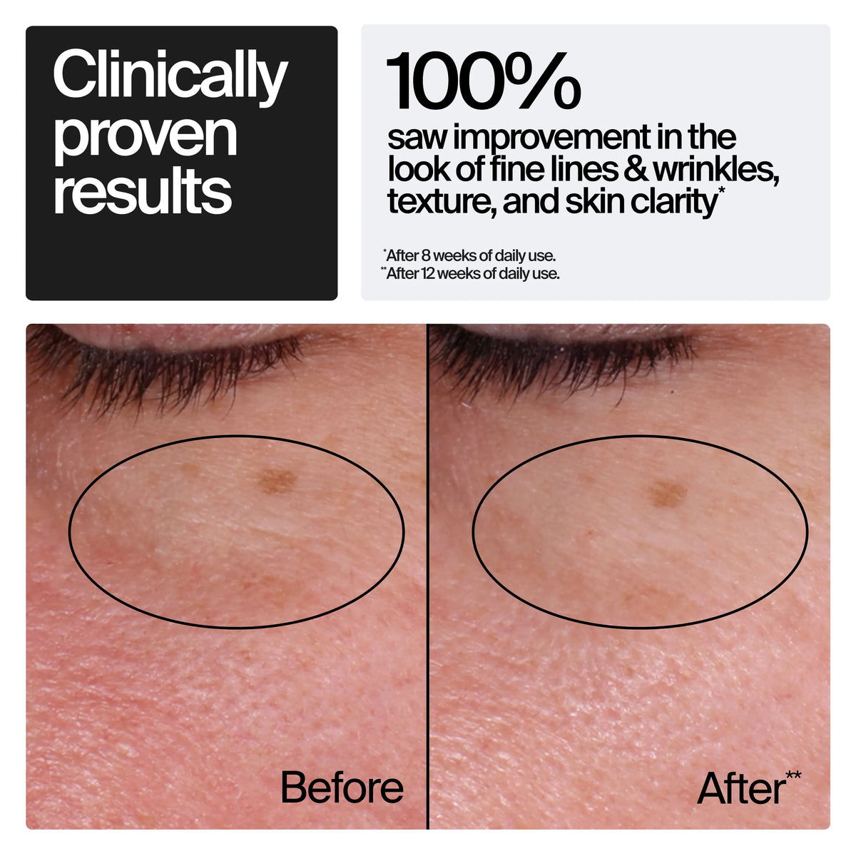 Neutrogena® Rapid Wrinkle Repair Retinol Regenerating Cream product image 2