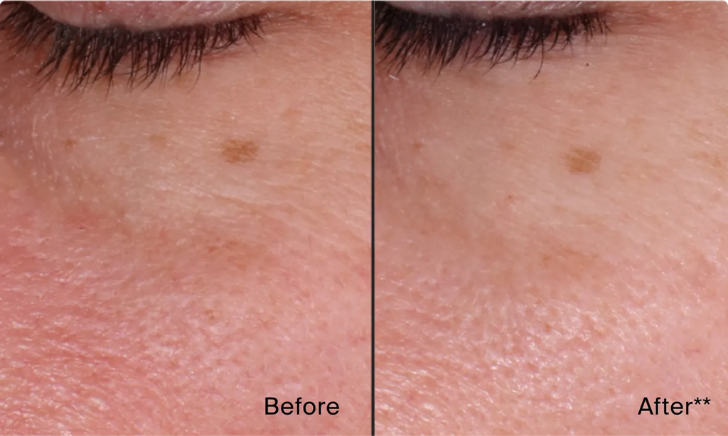 Neutrogena® Rapid Wrinkle Repair Retinol Regenerating Cream, Fragrance-Free product image 10