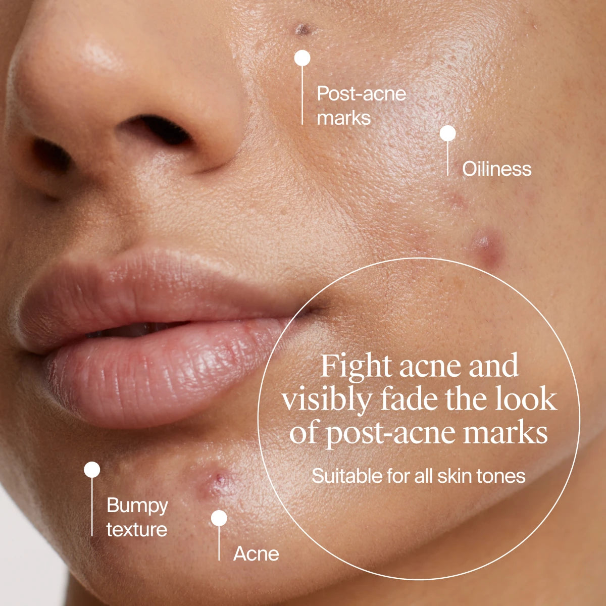 Neutrogena® Evenly Clear™ Acne Cleanser product image 3