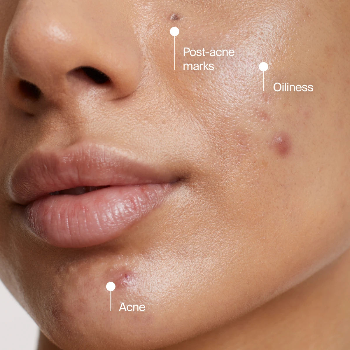 Neutrogena® Evenly Clear™ Acne Cleansing Mask product image 8