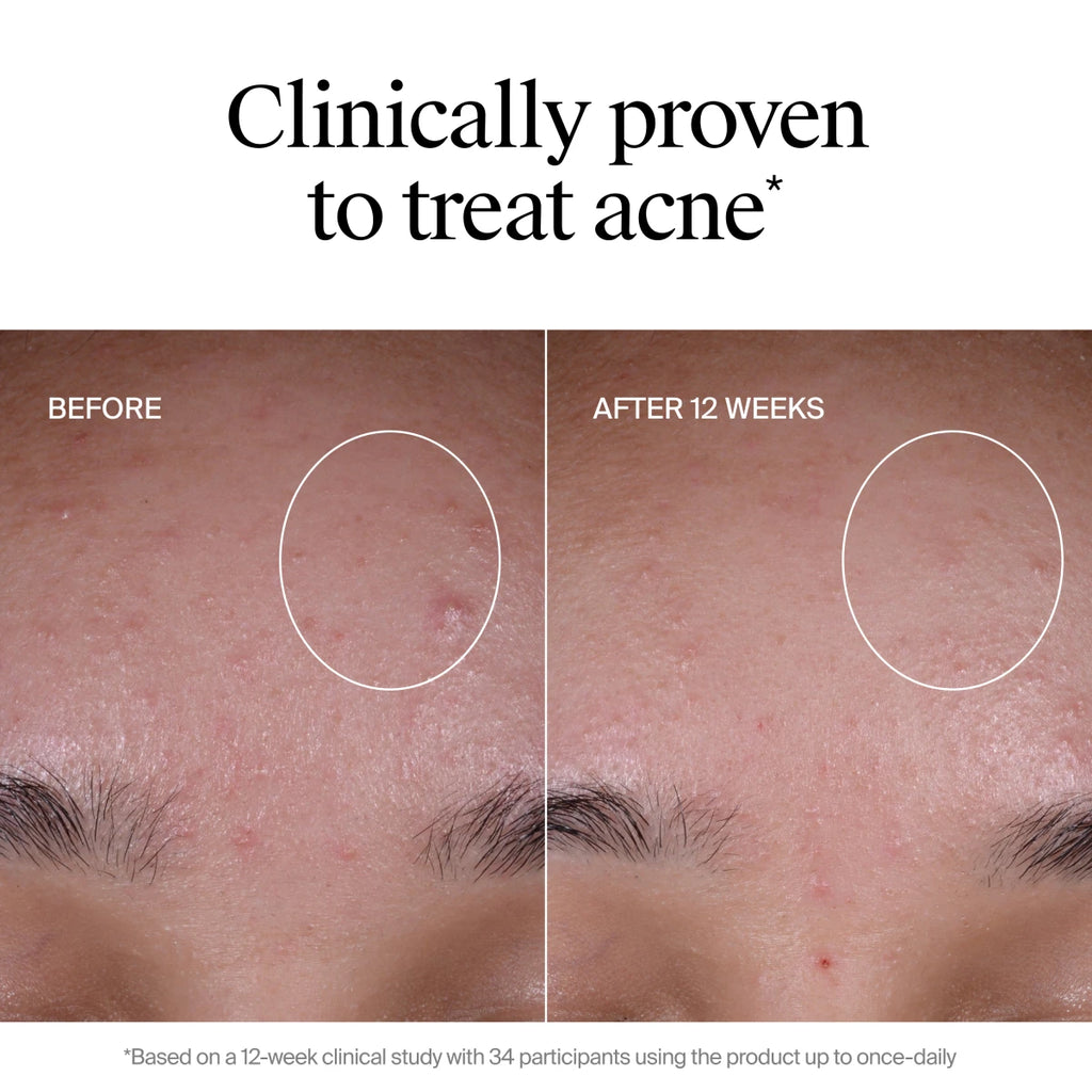Neutrogena® Evenly Clear™ Acne Exfoliant product image 6