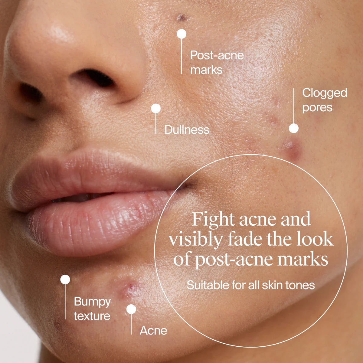 Neutrogena® Evenly Clear™ Acne Exfoliant product image 3