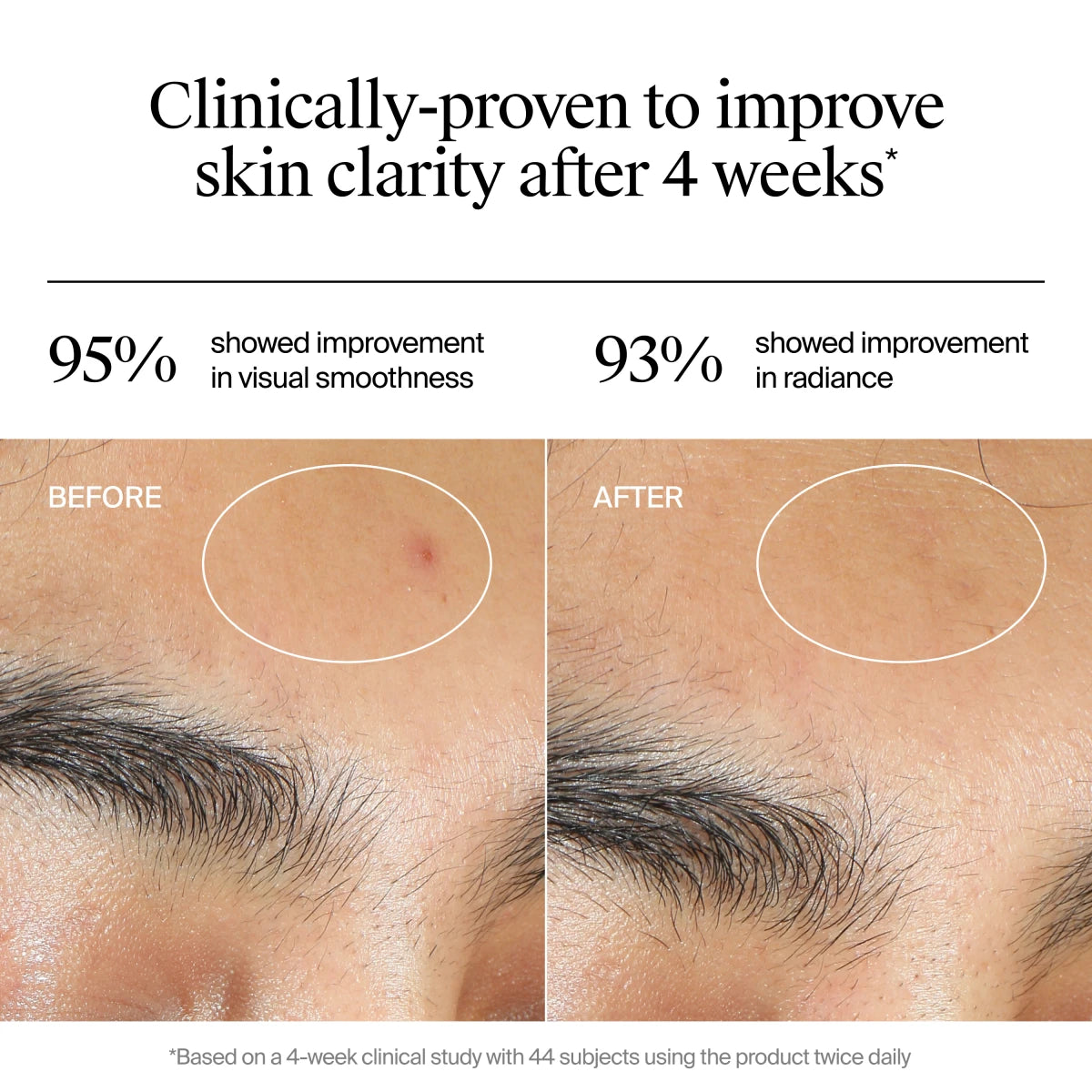 Neutrogena® Evenly Clear™ Acne Gel Moisturizer product image 6