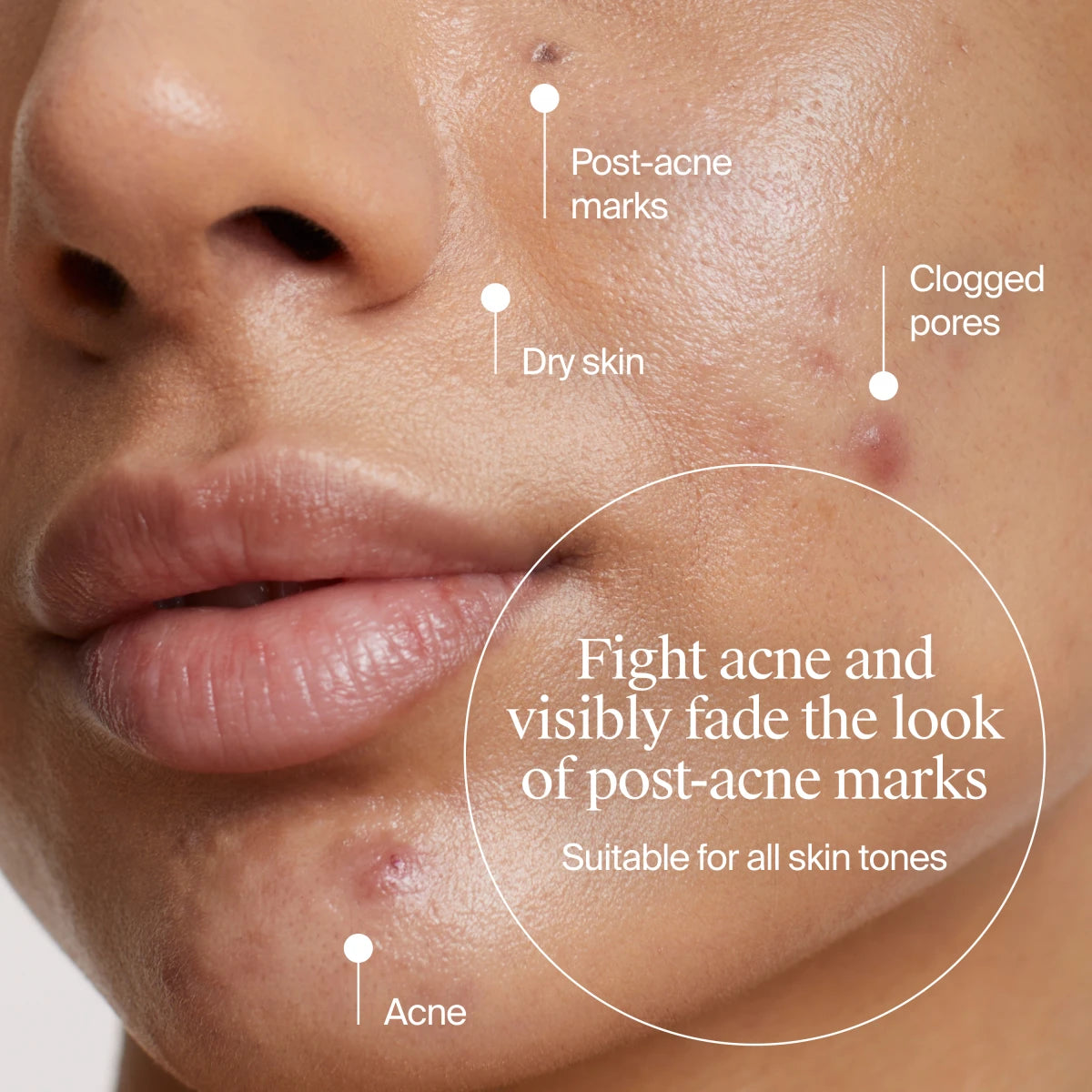 Neutrogena® Evenly Clear™ Acne Gel Moisturizer product image 3