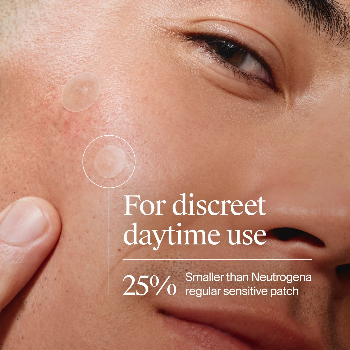 Neutrogena® Mini Acne Patch, Sensitive Skin product image 3