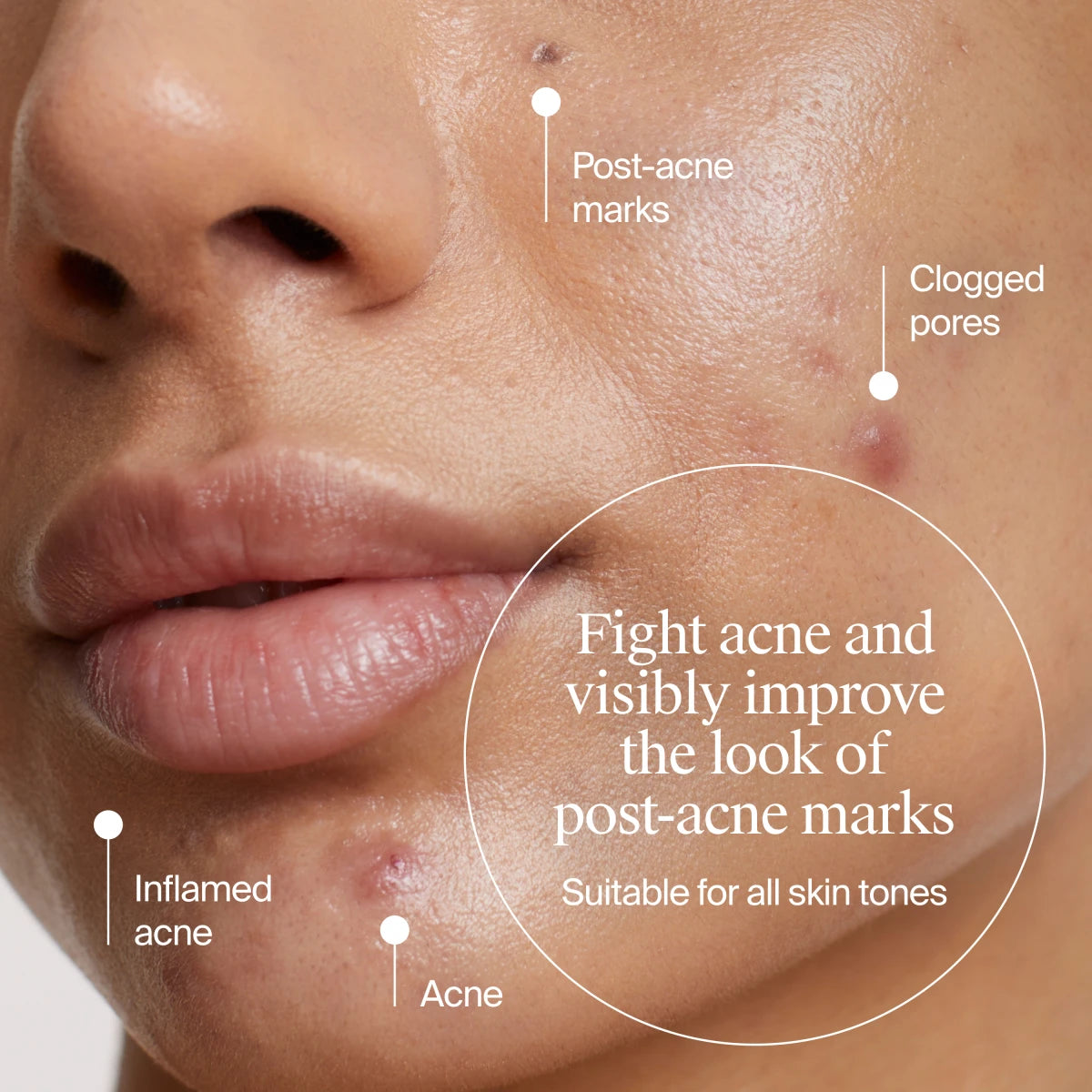 Neutrogena® Evenly Clear™ Retinoid Adapalene Gel 0.1% Acne Treatment product image 3