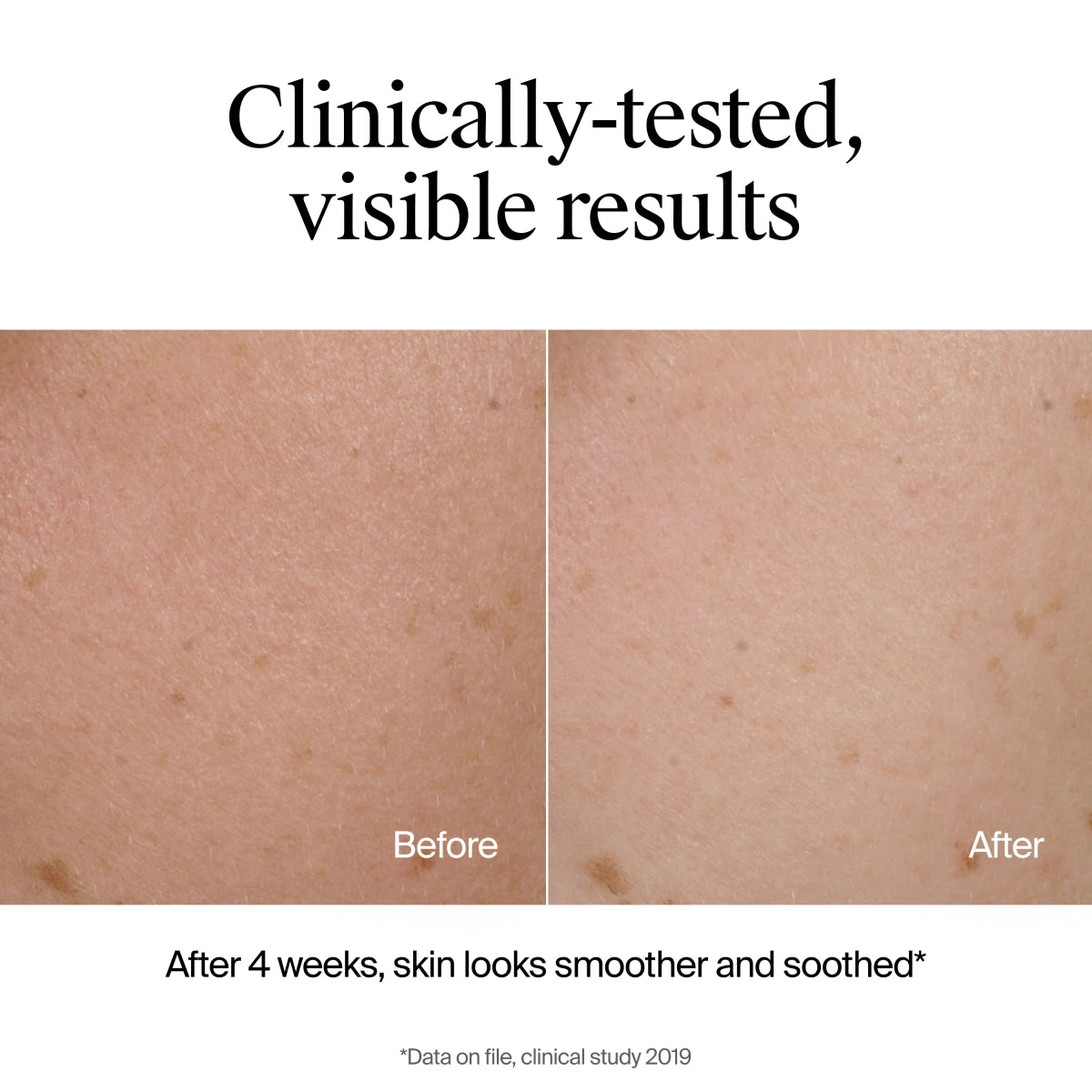 Neutrogena® Hydro Boost Soothing Milk Cleanser Fragrance Free product image 6