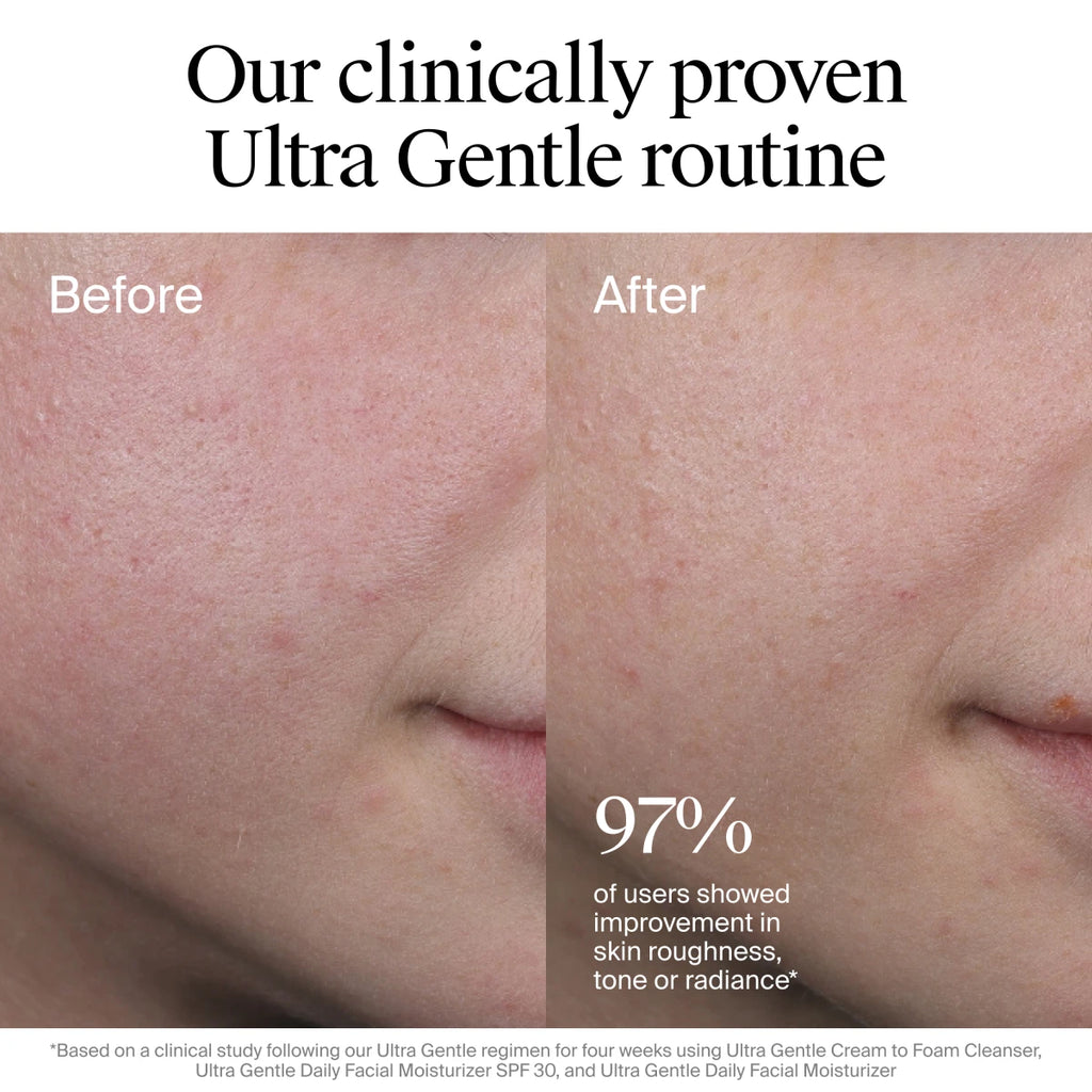 Neutrogena® Ultra Gentle Daily Facial Moisturizer with Broad Spectrum SPF 30 product image 5