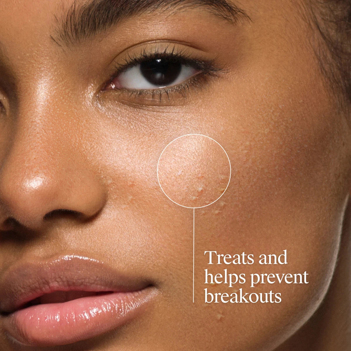 Neutrogena® Oil-Free Acne Wash, Fragrance Free product image 3
