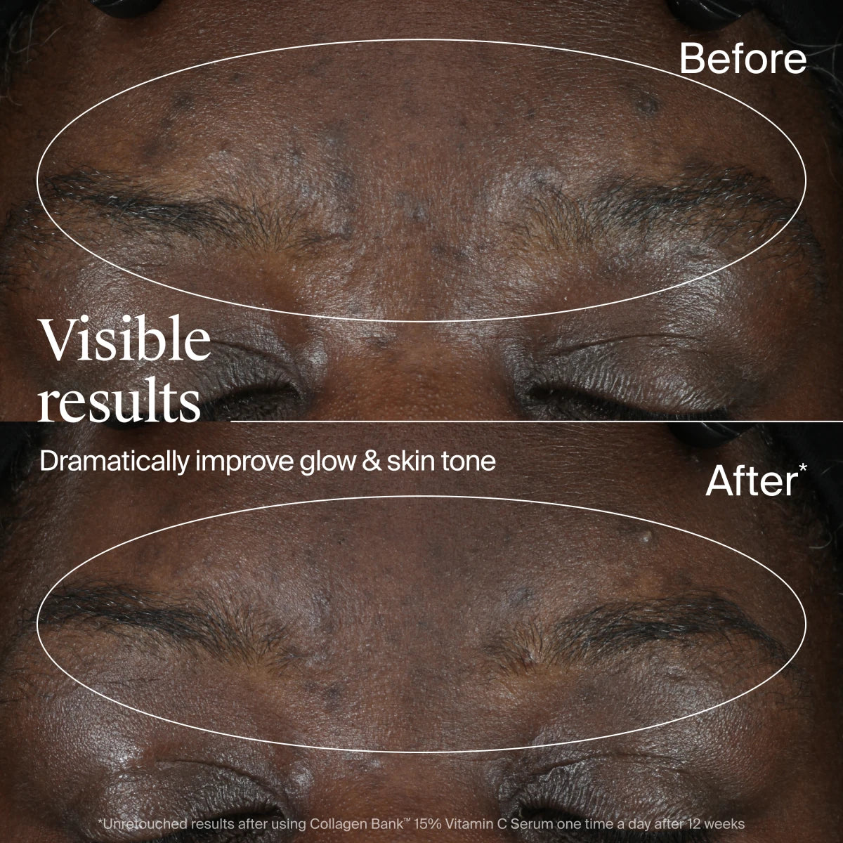 Neutrogena® Collagen Bank 15% Vitamin C Glow Serum product image 5
