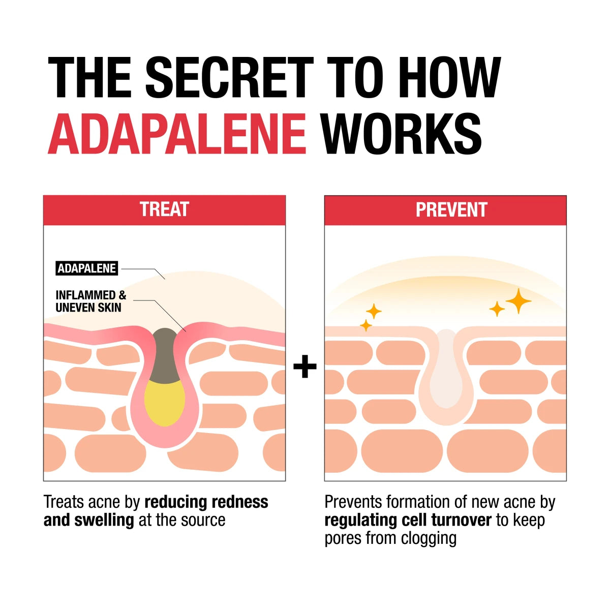 Neutrogena 0.1% Adapalene Gel Acne Treatment product image 3