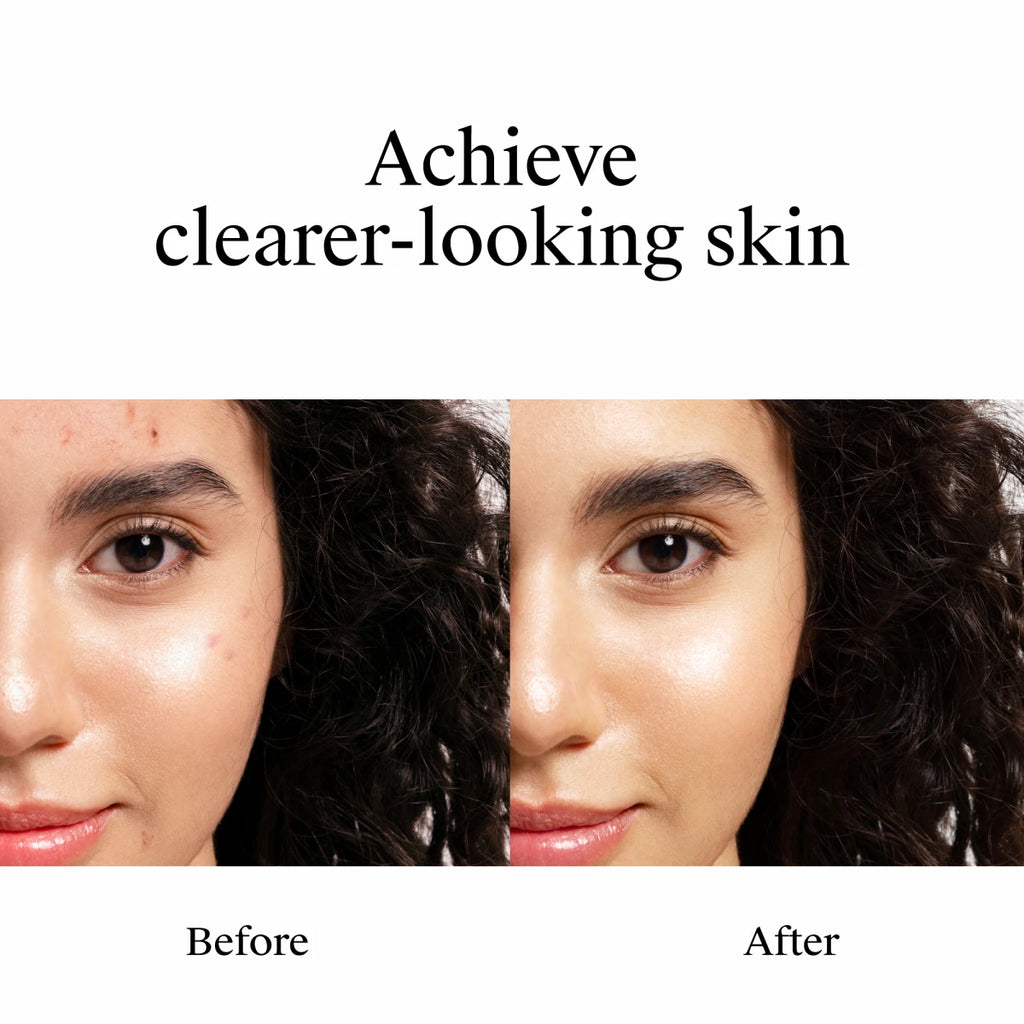 Neutrogena® Rapid Clear Stubborn Acne Spot Gel product image 3