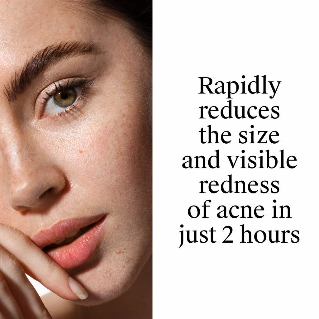 Neutrogena® Rapid Clear Stubborn Acne Spot Gel product image 6