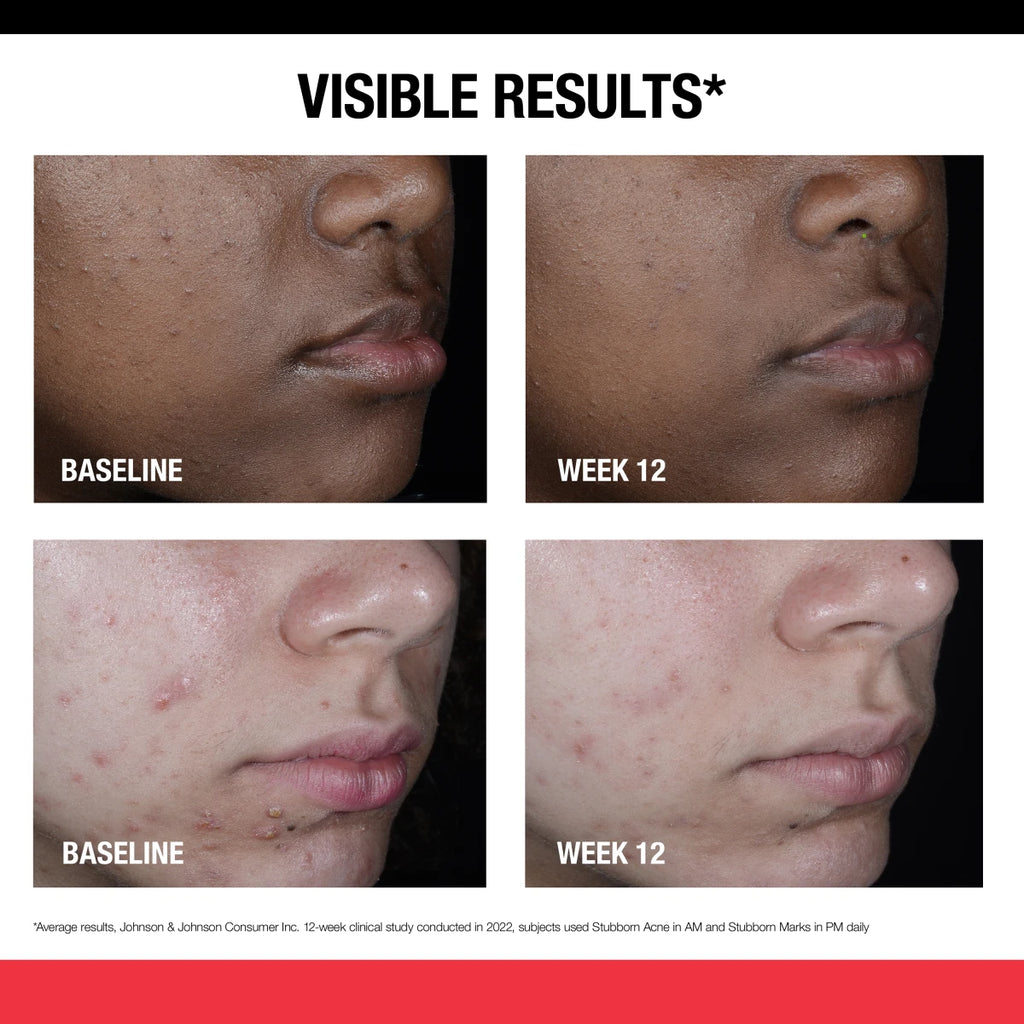 Neutrogena® Stubborn Marks PM Treatment product image 4