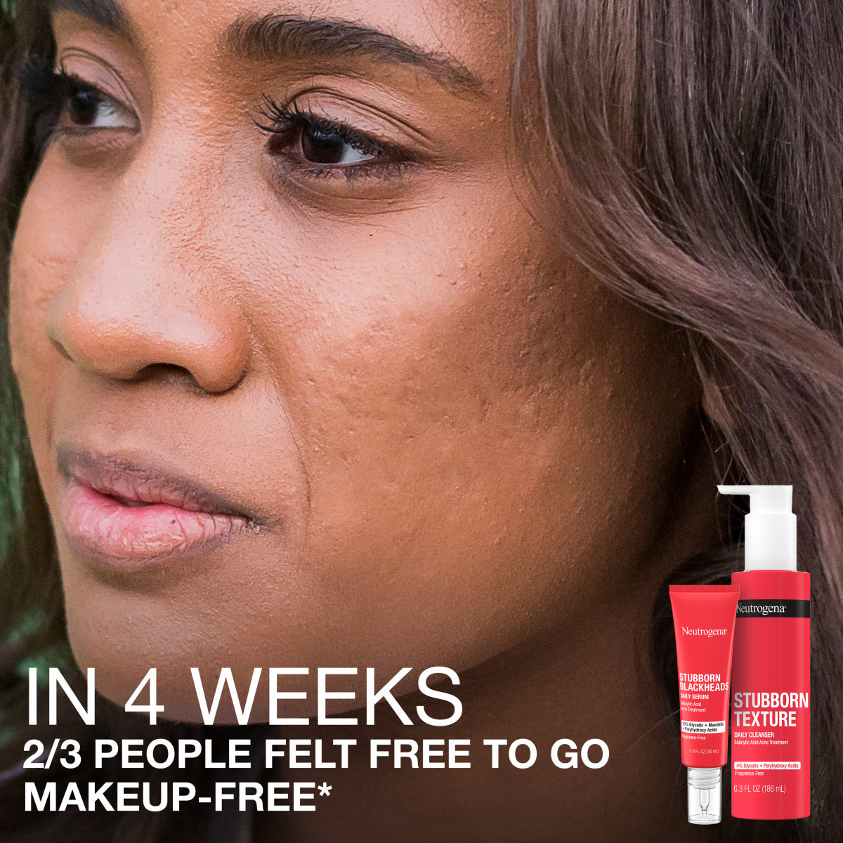 Neutrogena® Stubborn Blackheads Daily Acne Facial Serum product image 5