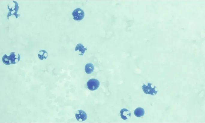 Neutrogena® Evenly Clear™ Acne Gel Moisturizer product image 17